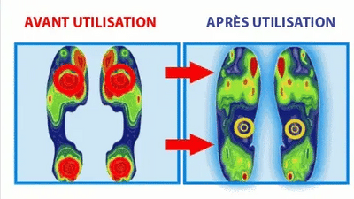 Chaussures orthopédiques en Similicuir  Style et Bien-être femme