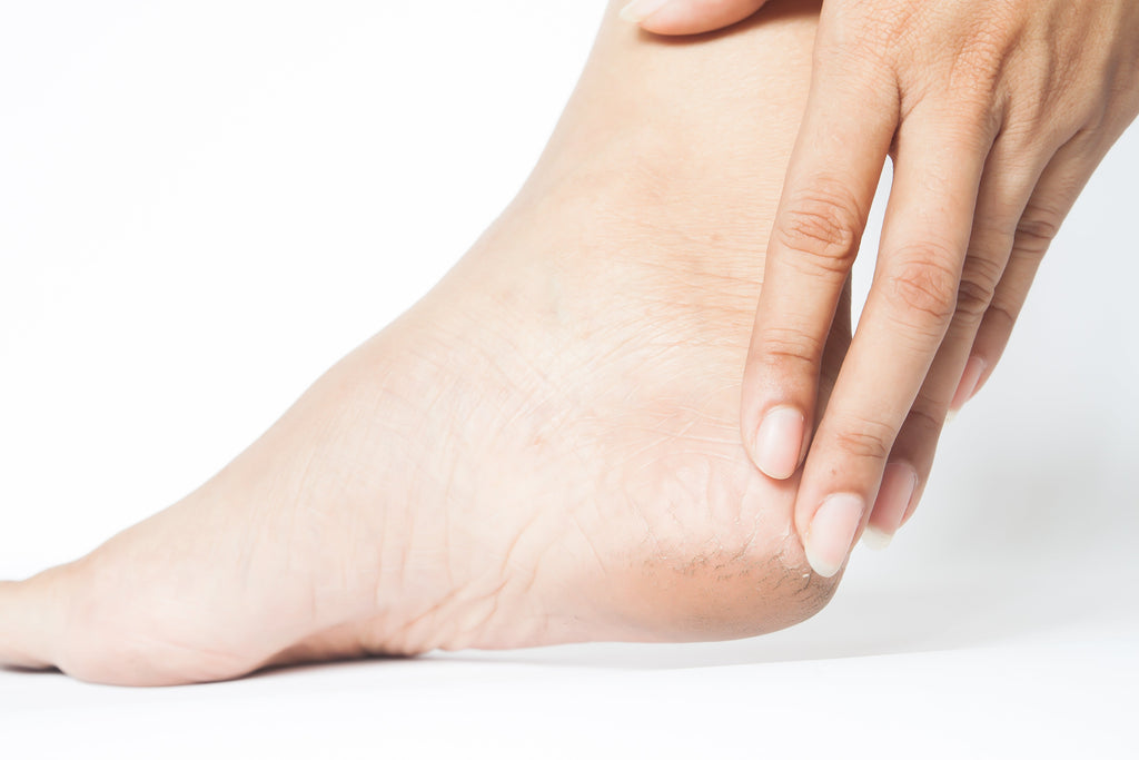 Neuroma de Morton: síntomas, causas y soluciones para aliviar este dolor.